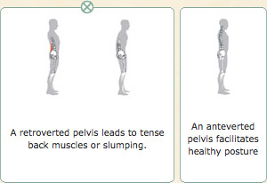 Anteverted pelvis